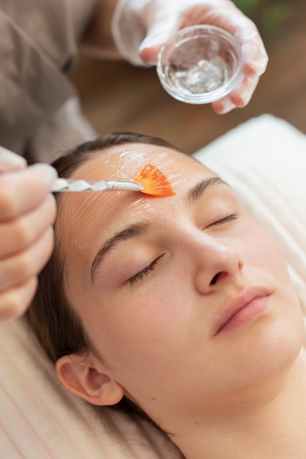 Medical chemical peel application at EliteMD Aesthetics in Markham