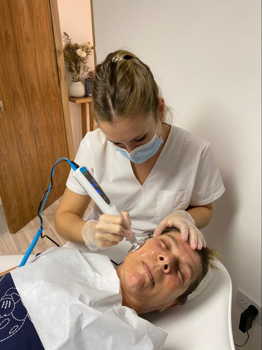 Electrocautery skin tag removal at EliteMD Aesthetics in Markham