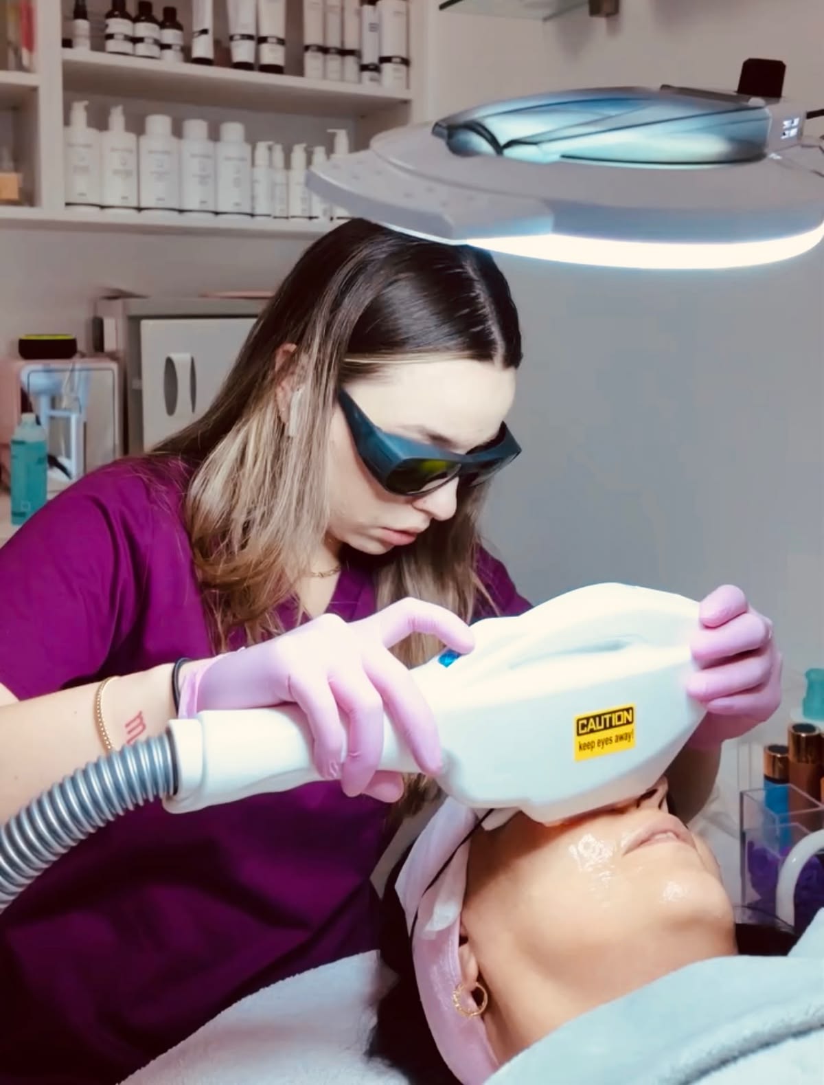 Q-switched laser pigment treatment at EliteMD Aesthetics in Markham