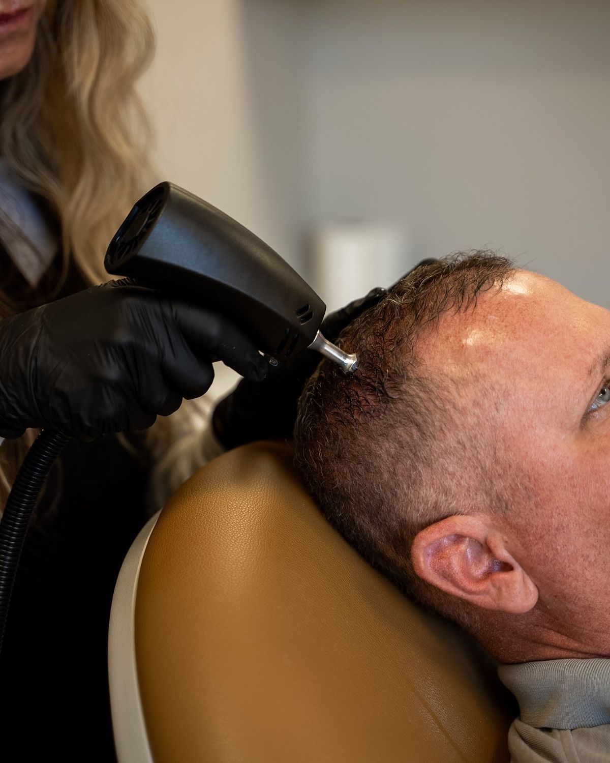 Alma TED needle-free hair restoration at EliteMD Aesthetics in Markham